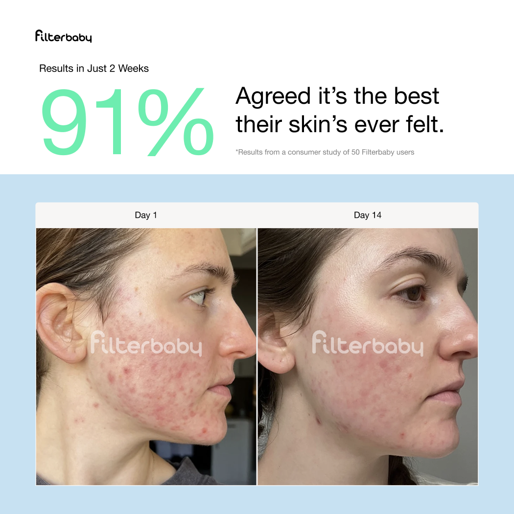 Filterbaby Skincare Faucet Filter 2.0: Chrome