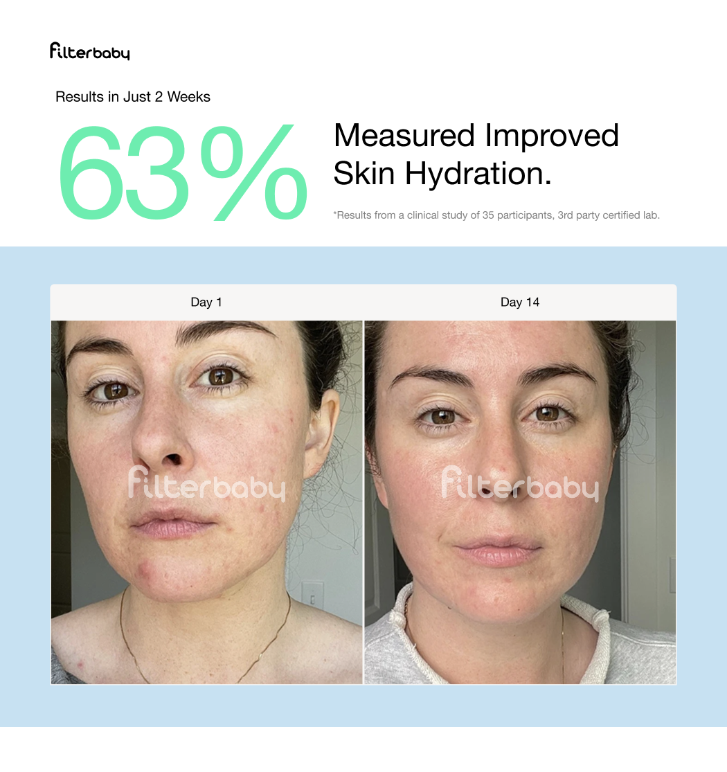 Filterbaby Skincare Faucet Filter 2.0: Chrome