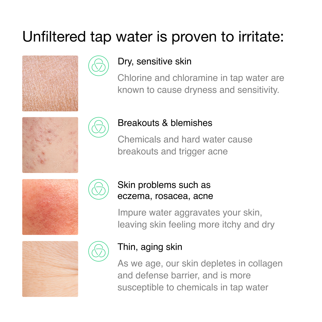 Filterbaby Skincare Faucet Filter 2.0: Chrome
